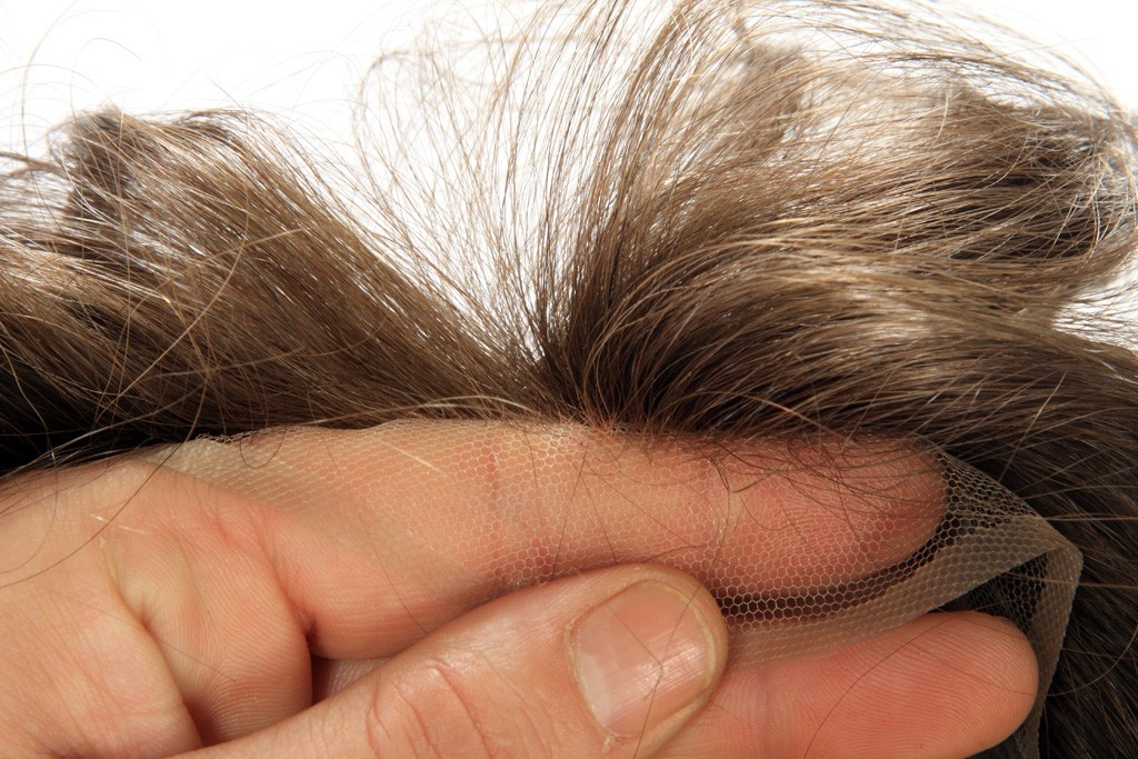 protesi capelli Genova protesi capelli Genova